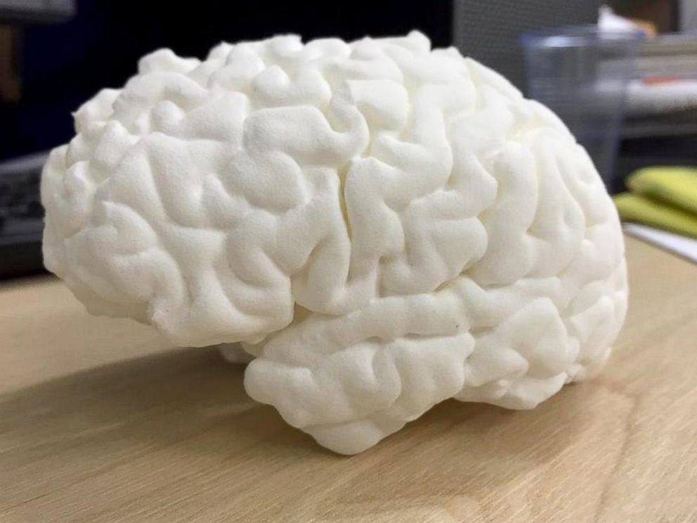 3D Printing in Medical Devices: Clinical & Engineering Analysis