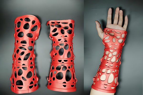 High-Precision SLA 3D Printing for Healthcare: Medical Prototypes