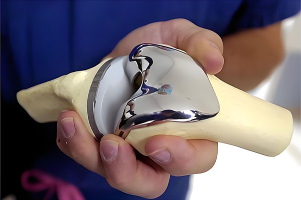 Medical implant surface finish